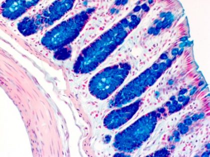 Rat colon alcian blue – Histotechnology